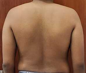 Back