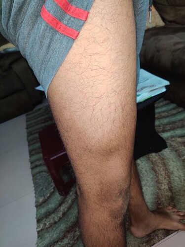 Thigh muscle 1